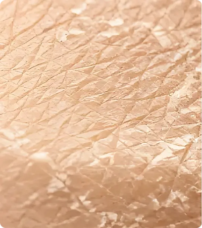 large, sagging pores