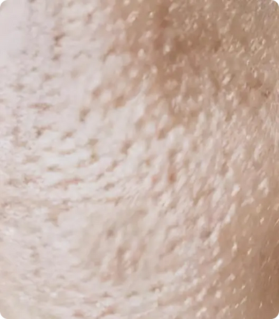 dull, rough skin