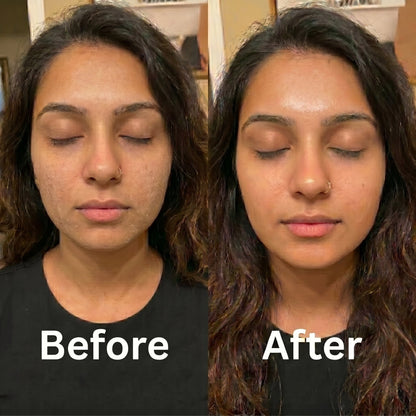 Hydrogel Collagen Mask - Korean Science (Premium)